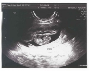 Ultrasound image of one of Norah's puppies